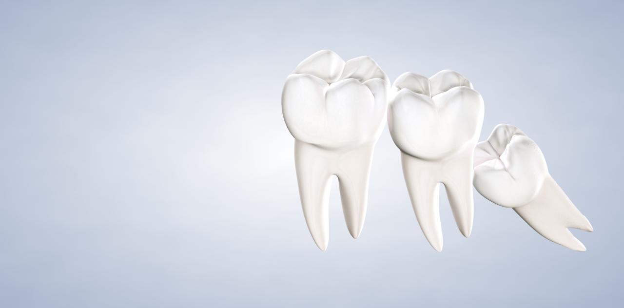 Wisdom Teeth Only by Specialists